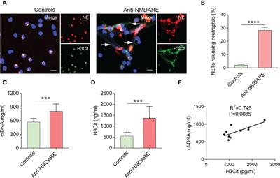 Increased formation of neutrophil extracellular traps in patients with anti-N-methyl-d-aspartate receptor encephalitis